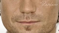 Restylane after treatment